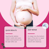 EELHOE Vitamin E Skin Care Oil Remove Pregnancy — vue complémentaire 3