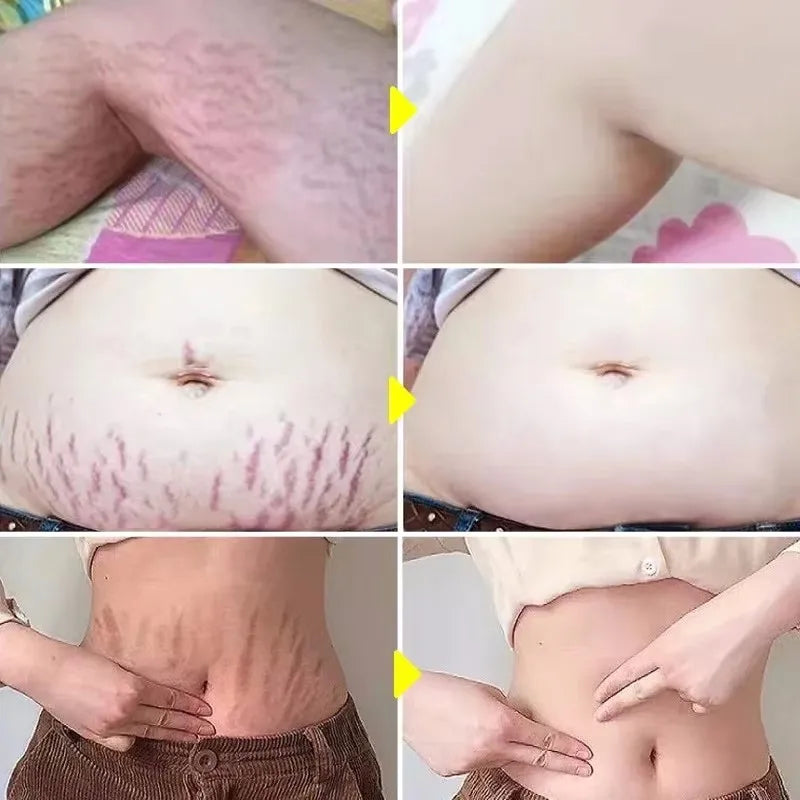 Vêtement grossesse — vue face | Bouni