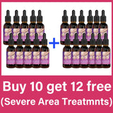 Body essential oil suitable for pregnant women, — vue complémentaire 4