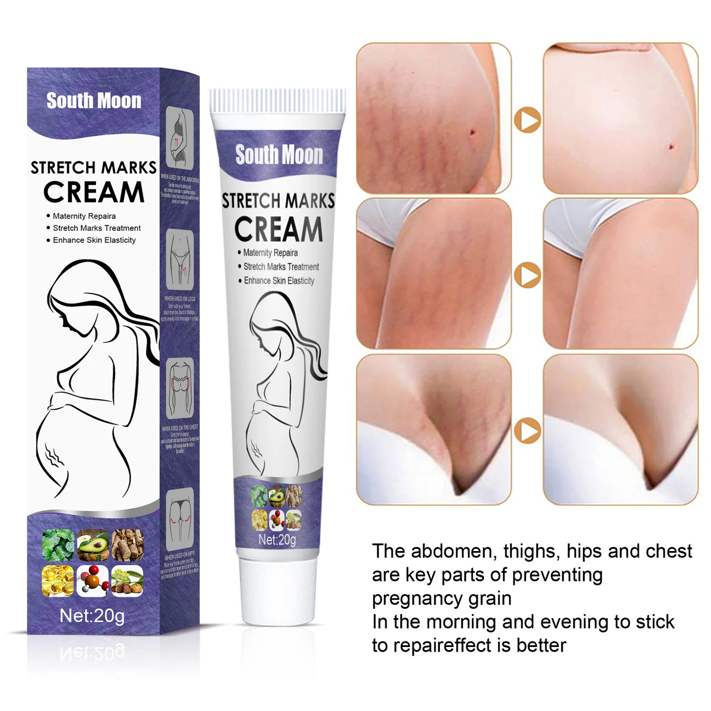 Remove Pregnancy Stretch Marks Cream Improves E — vue complémentaire 1