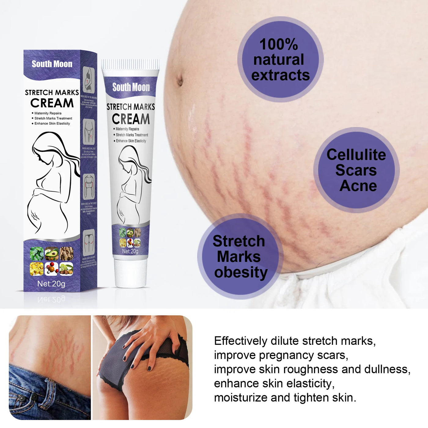 Remove Pregnancy Stretch Marks Cream Improves E avec accessoires inclus | Bouni