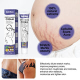 Remove Pregnancy Stretch Marks Cream Improves E avec accessoires inclus | Bouni