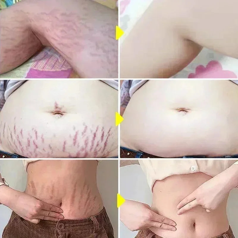 Vêtement grossesse avec accessoires inclus | Bouni
