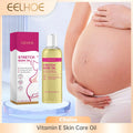 EELHOE Vitamin E Skin Care Oil Remove Pregnancy 100ml en situation d'utilisation